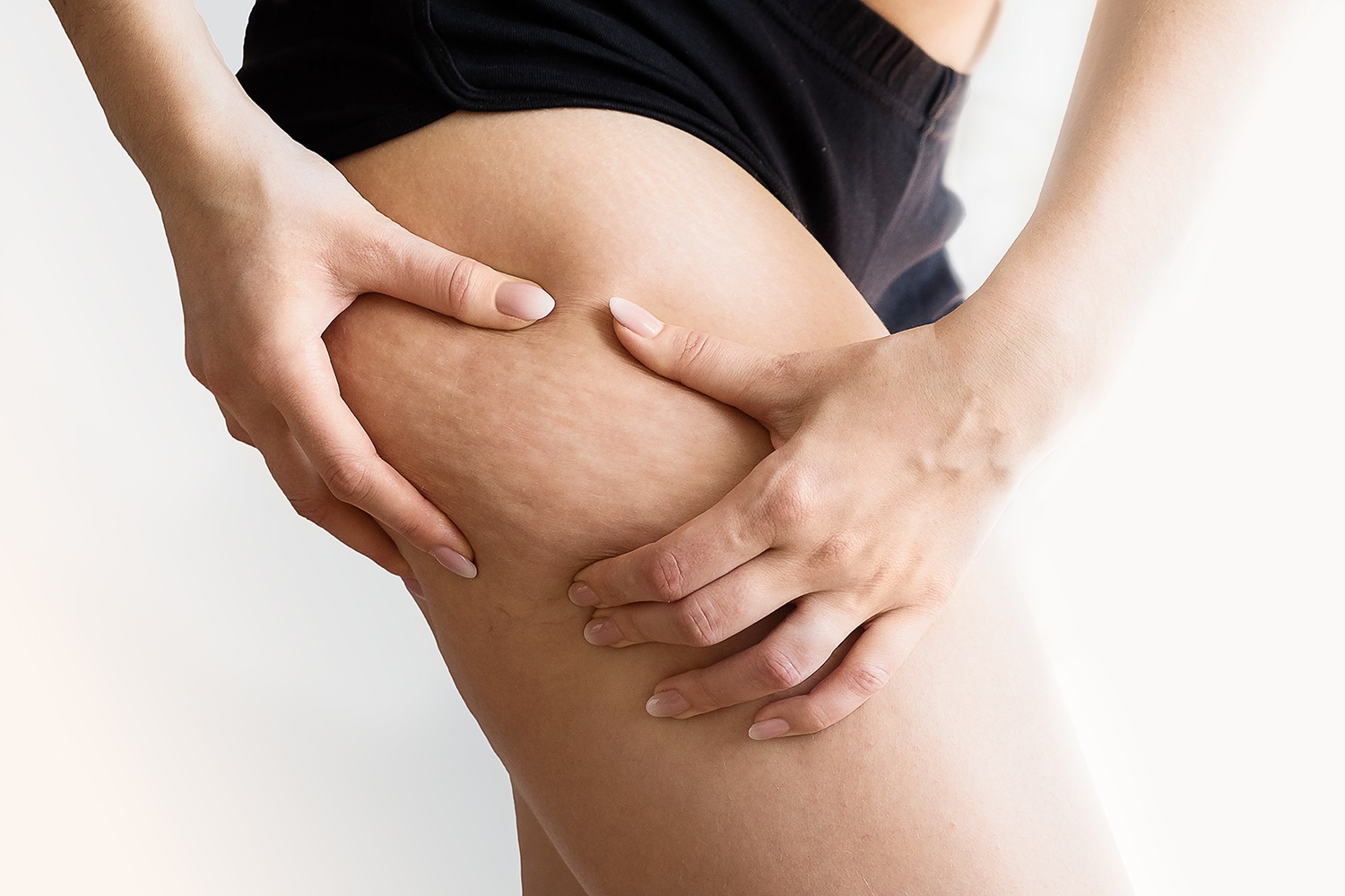 trattamento cellulite